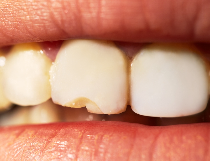 Cheap dentistry can have negative results.