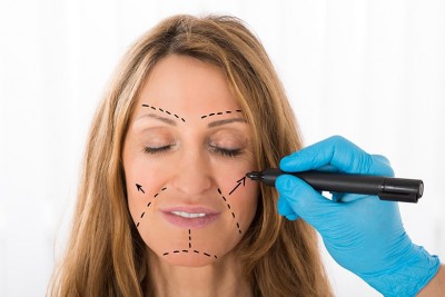 Surgeon Drawing Correction Lines On Woman Face - In Hilton Head, SC Dr. Rod Strickland offers Non-Surgical Dentistry for your facelift, no scars