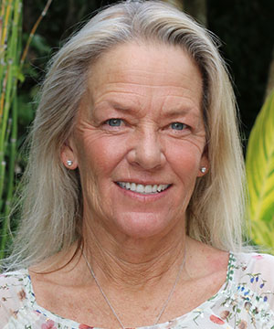 An after photo of a patient of Beyond Exceptional Dentistry An after photo of a patient of Beyond Exceptional Dentistry